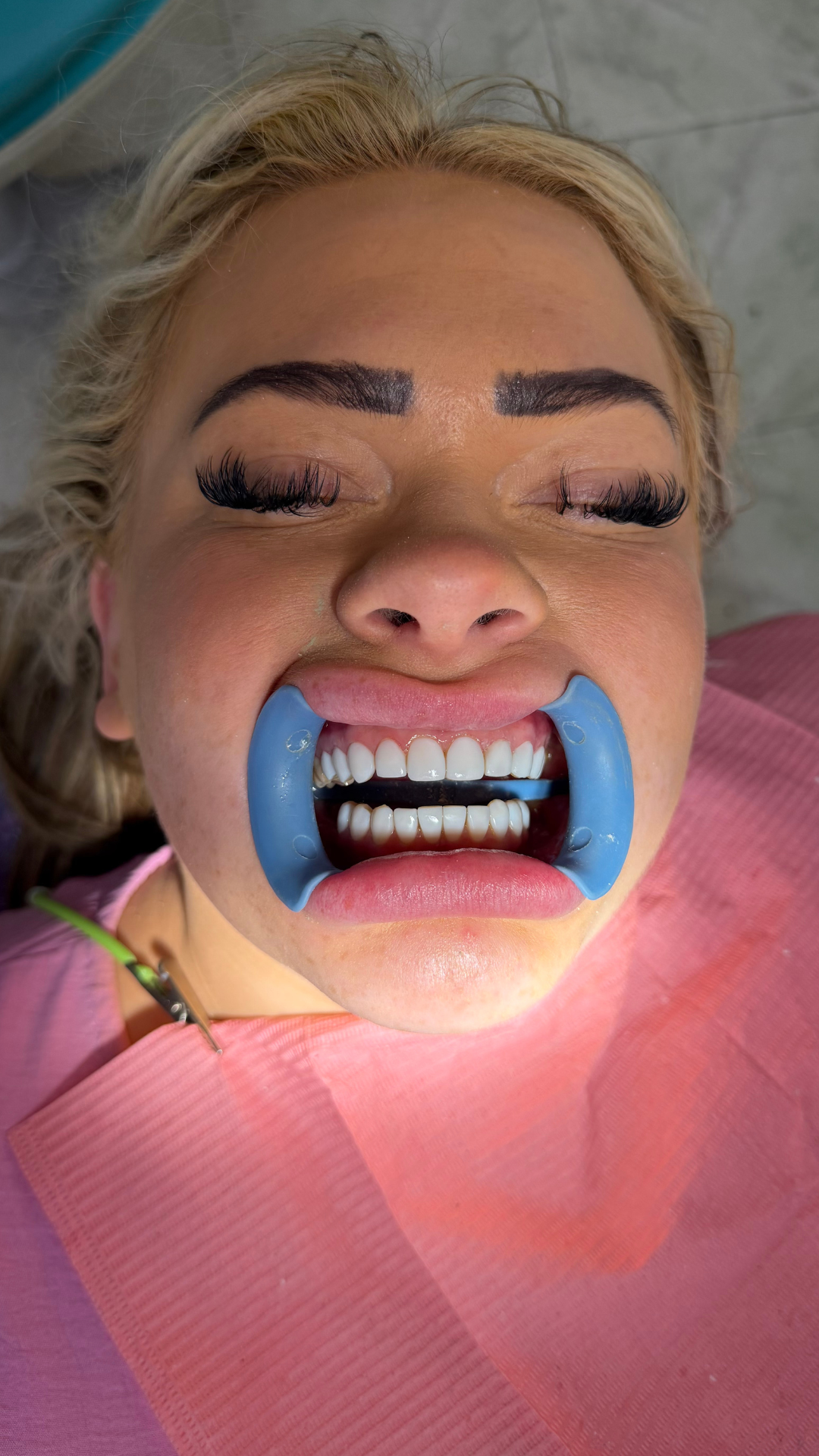 Beyond Smiles Review 11