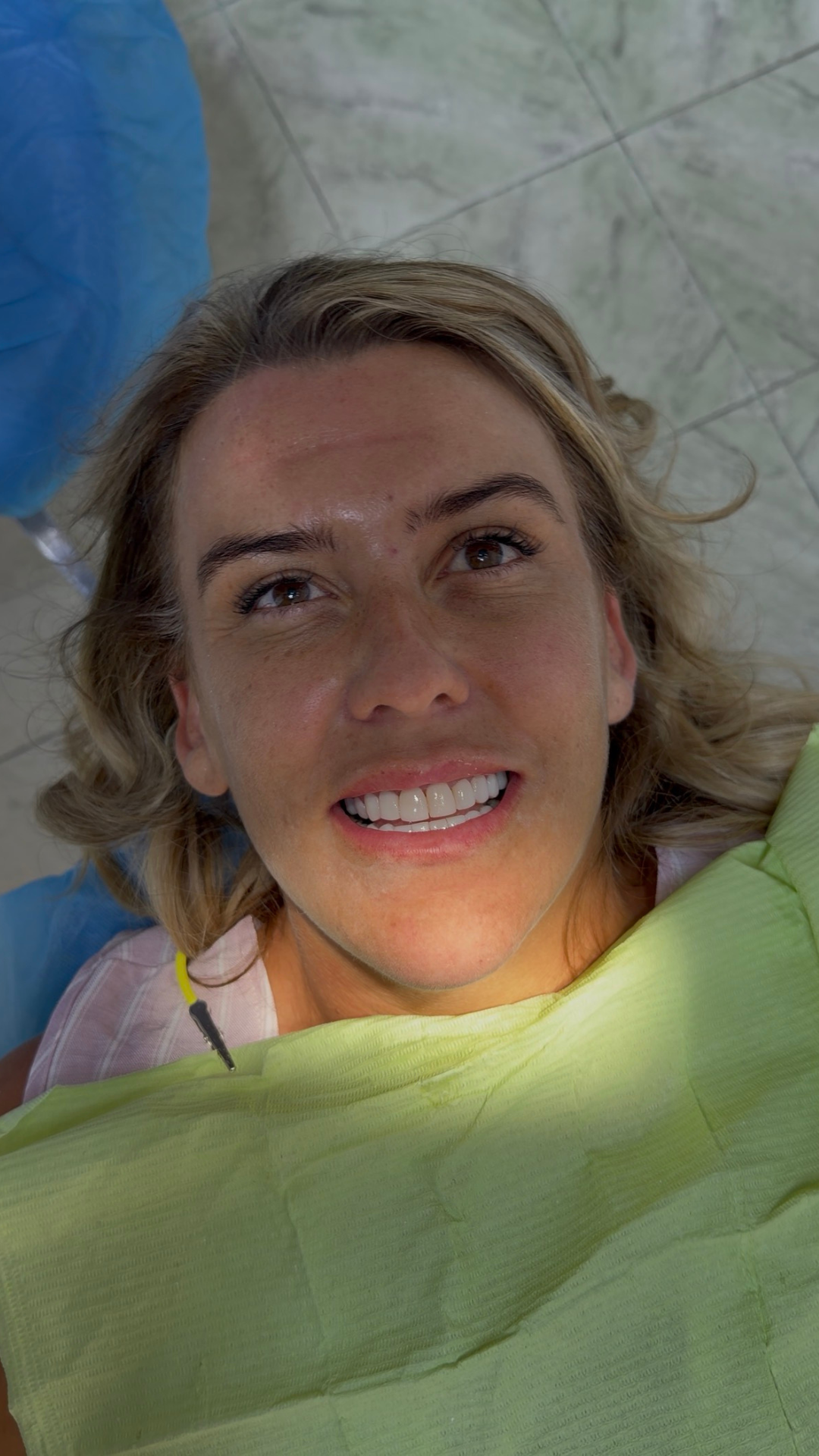 Beyond Smiles Review 4