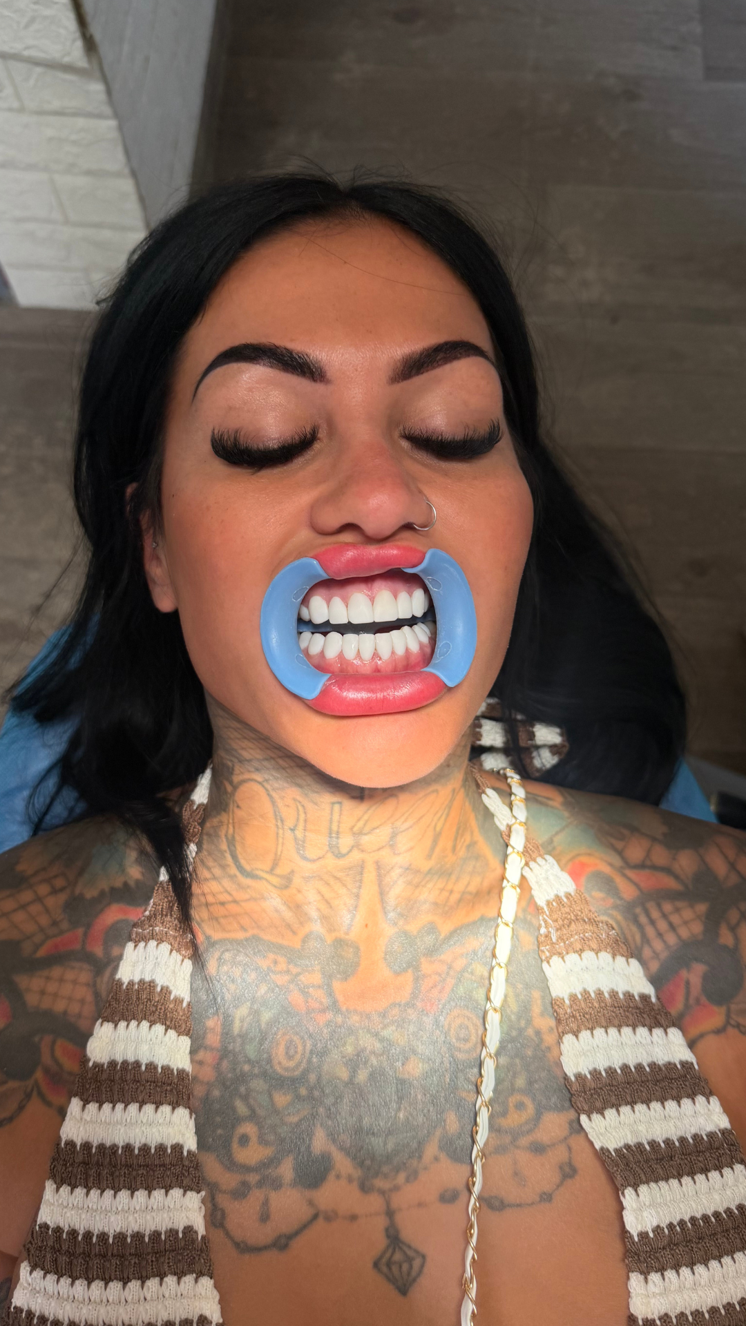 Beyond Smiles Review 8
