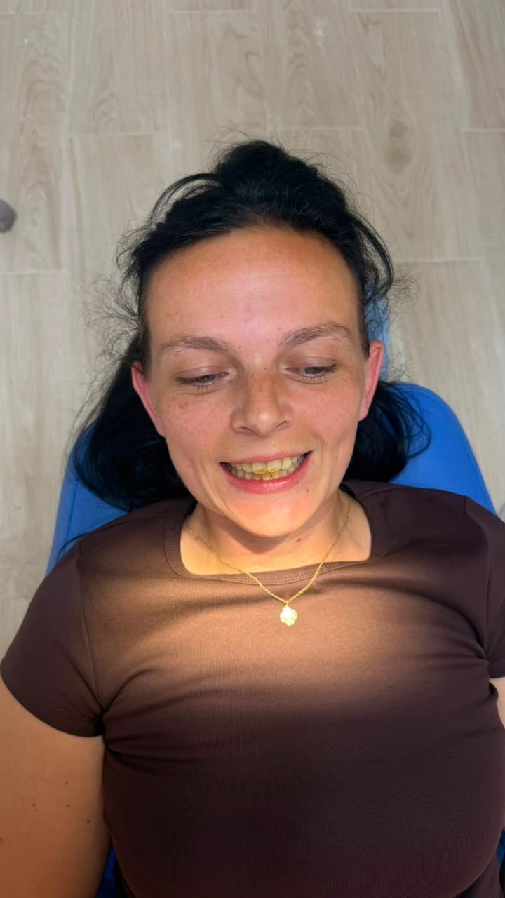 Happy Client 5 Before